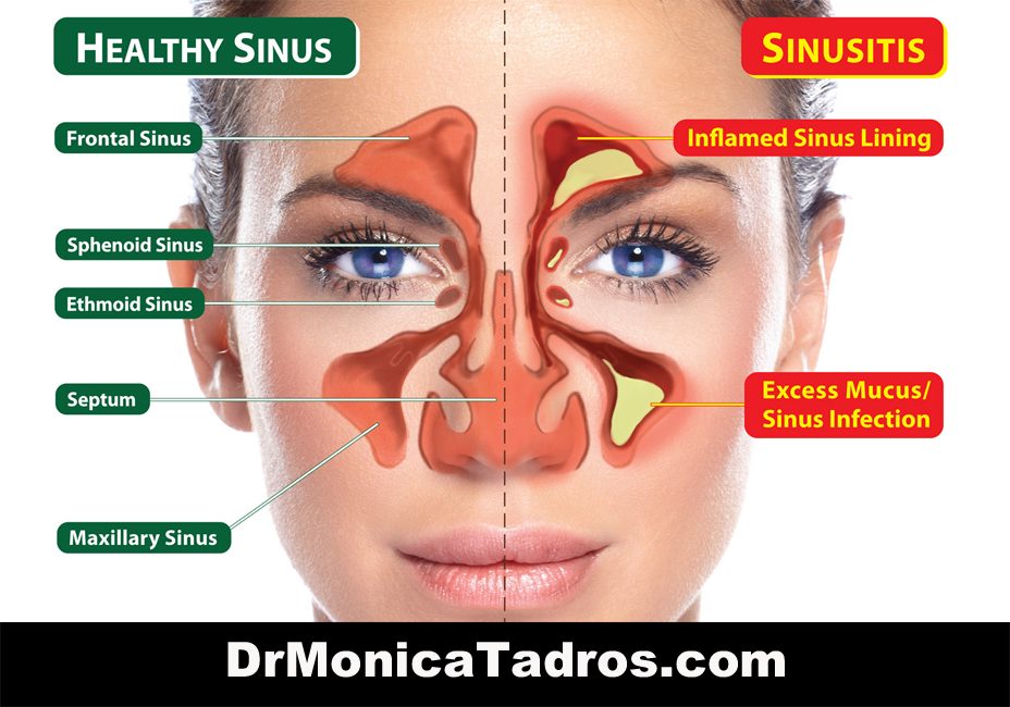 Sinus Surgery Cost – Prices, Insurance & What to Expect