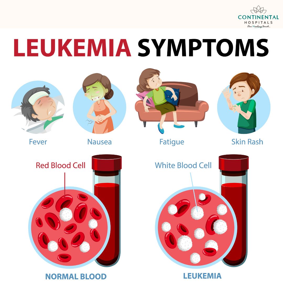 What Are the Six Signs of Leukemia? Quick Guide