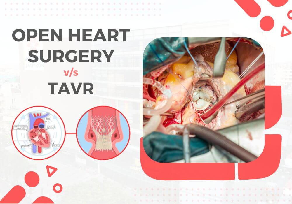 Cost of TAVR vs Open-Heart Surgery: What to Know