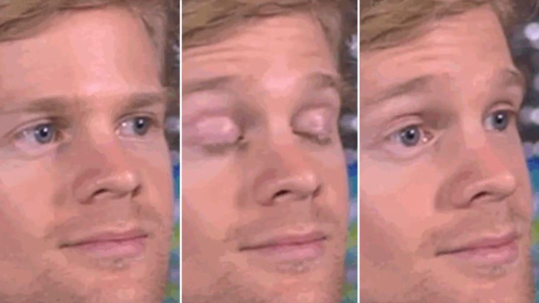 Intrusive Sleep ADHD Reddit: Real Tips & Insights