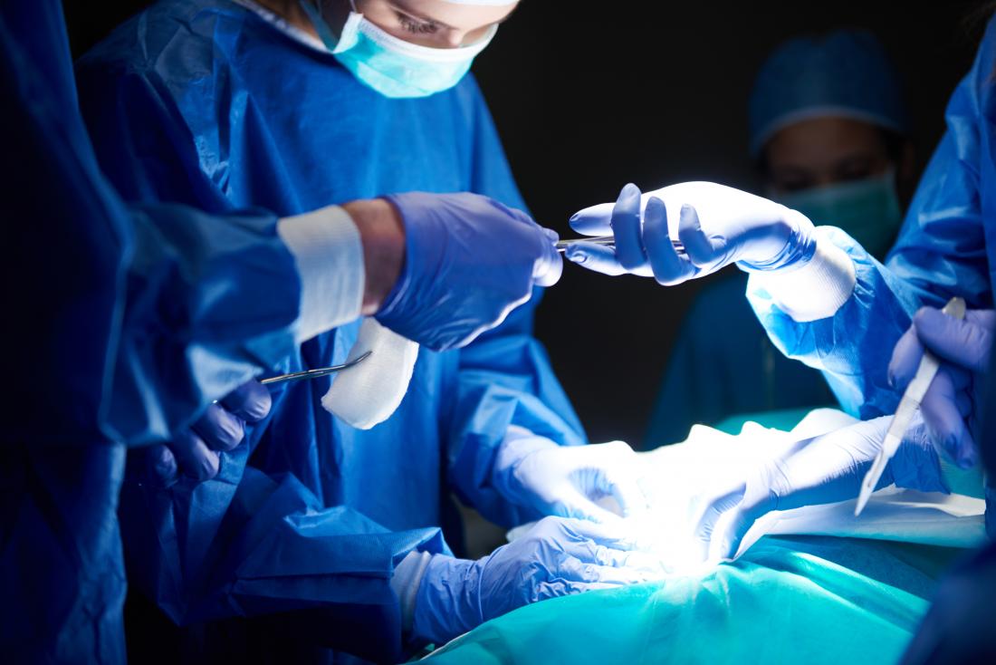 Top 10 Most Painful Surgery Recoveries to Expect