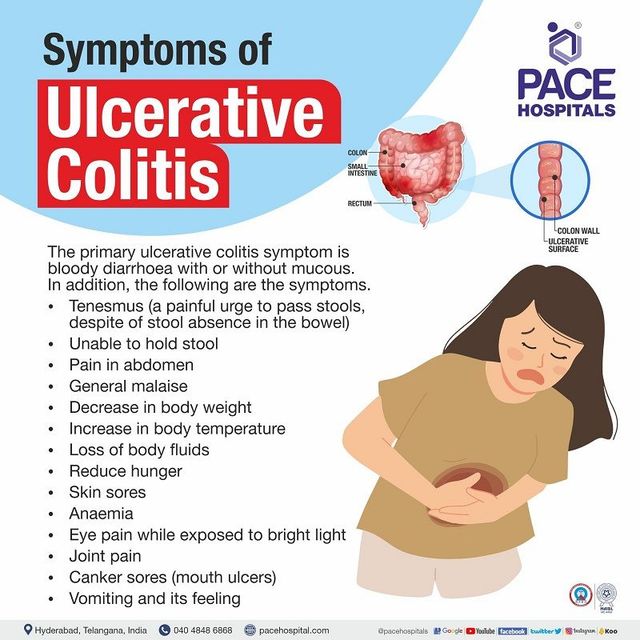Ulcerative Colitis Cancer Symptoms: What to Watch For