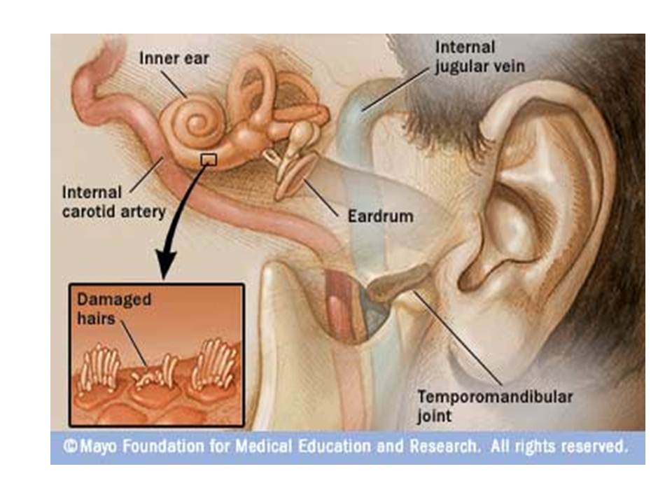 Can acupuncture make tinnitus worse? Facts & Answers