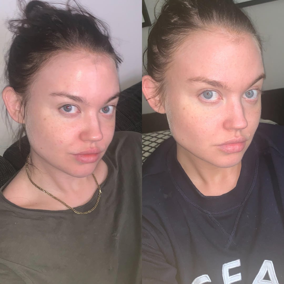 One Week Gluten‑Free Results: What You’ll Actually Notice