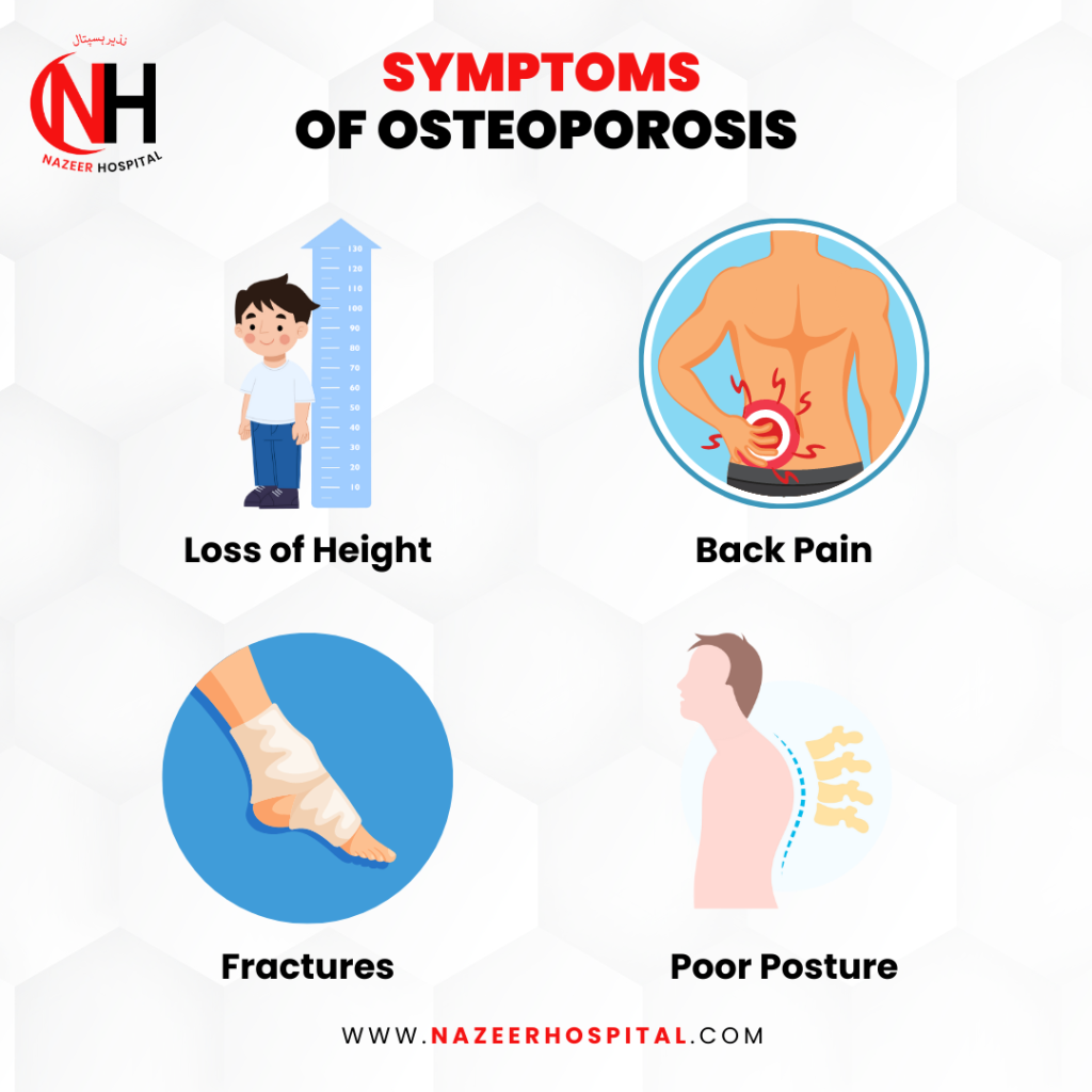 What are 5 Symptoms of Osteoporosis? Know the Signs