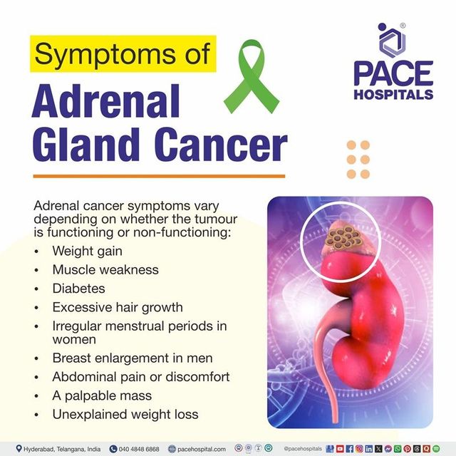 Adrenal Cancer Symptoms in Females – What to Look For