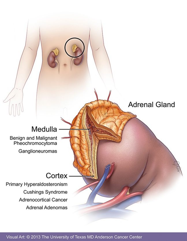 Adrenal Gland Nodule Treatment: What You Need to Know