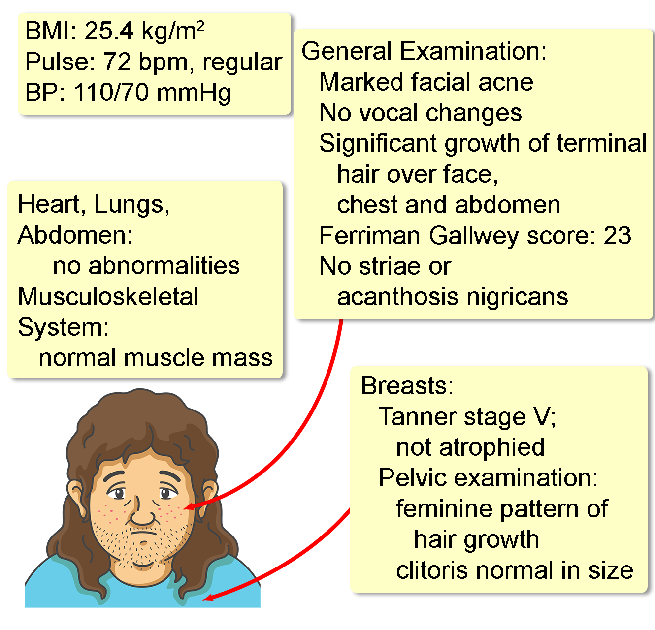 Androgen‑Secreting Tumor in Females Symptoms – Key Signs