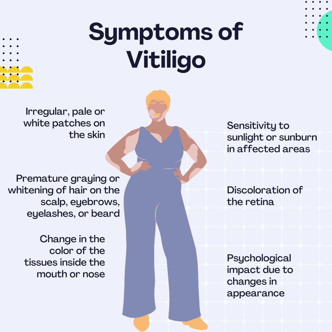 Causes of Vitiligo in Adults: What Really Triggers It