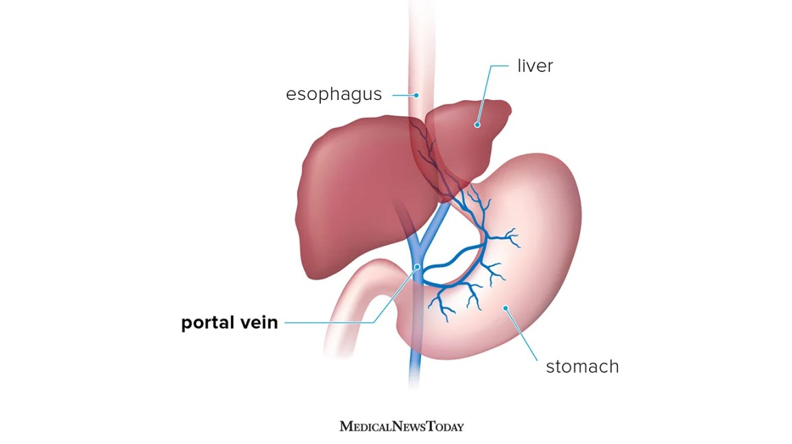 How Long Can You Live With Portal Hypertension?