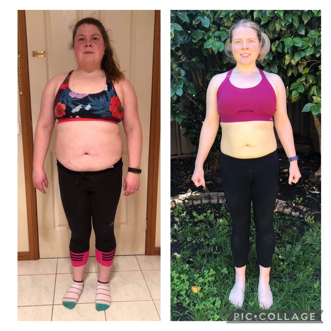 Lean PCOS Reddit: Real Talk, Symptoms & Treatment Tips