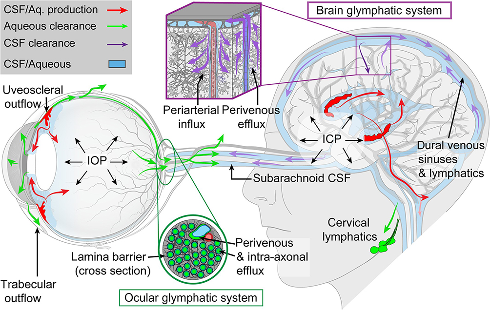 Normal‑Tension Glaucoma Pathophysiology Explained