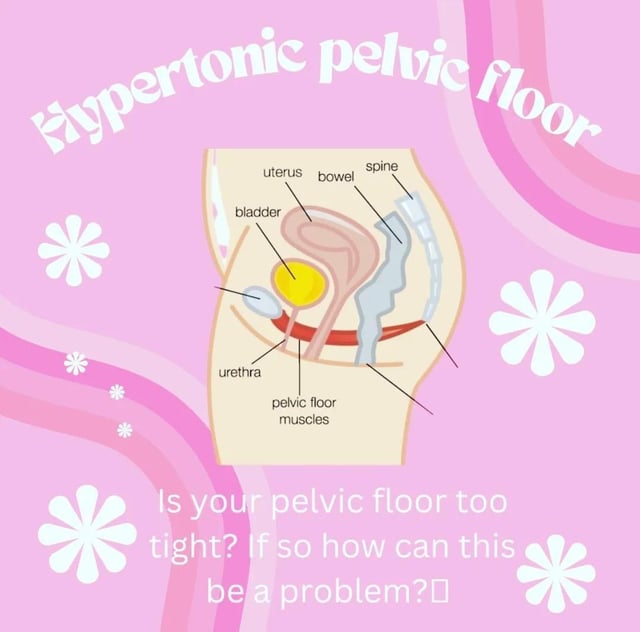 Pelvic Floor Constipation Reddit: Real Relief Tips