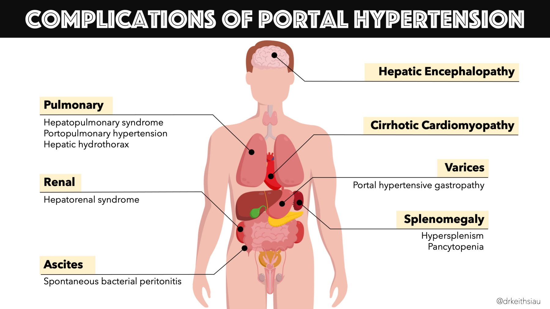 Portal Hypertension Complications: What You Need to Know