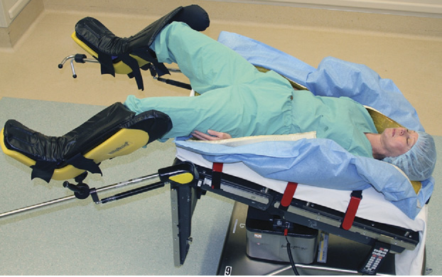 Robotic Prostatectomy Positioning: Benefits & Risks