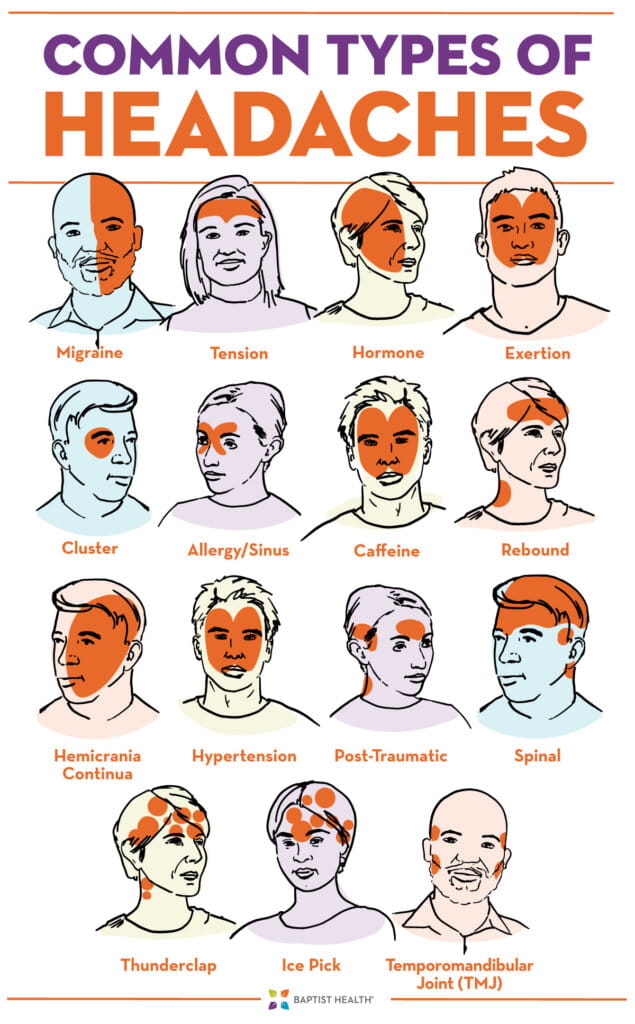 Explore Types of Headache Photos: Quick Guide & Tips