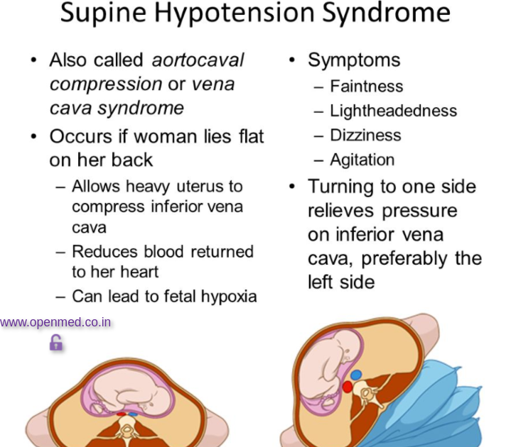 What Causes Supine Hypertension in Pregnancy – Quick Answers