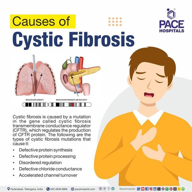 Why Can’t People With Cystic Fibrosis Meet? Explained