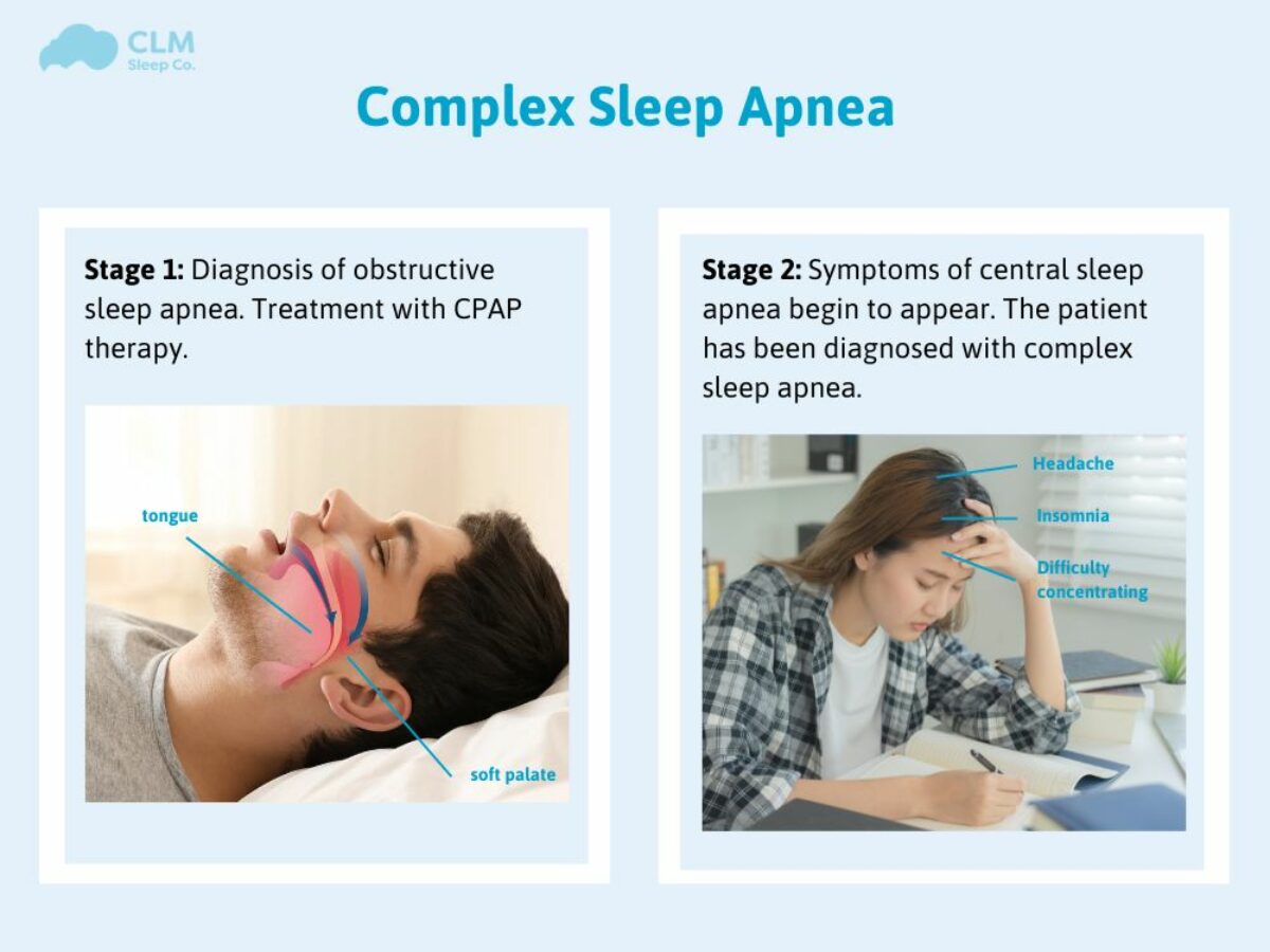 Central Sleep Apnea Treatment: Options & What Works