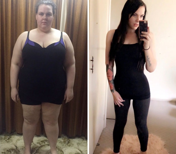 How to Fix Thyroid Weight Gain: Proven, Simple Steps