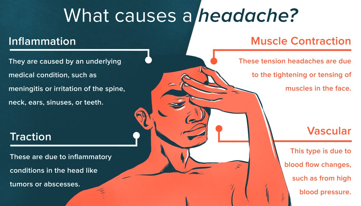 How to Relieve a Tension Headache Fast: Quick Tips