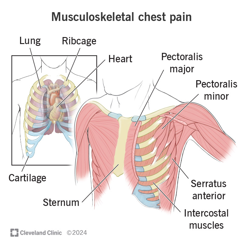 Musculoskeletal Chest Pain Left Side: Causes & Relief