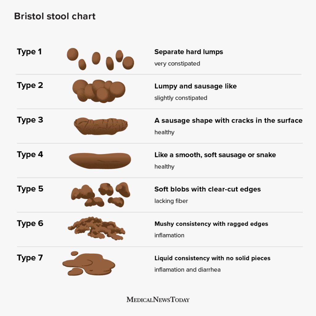 13 Home Remedies When My Poop Is Too Big and Hurts