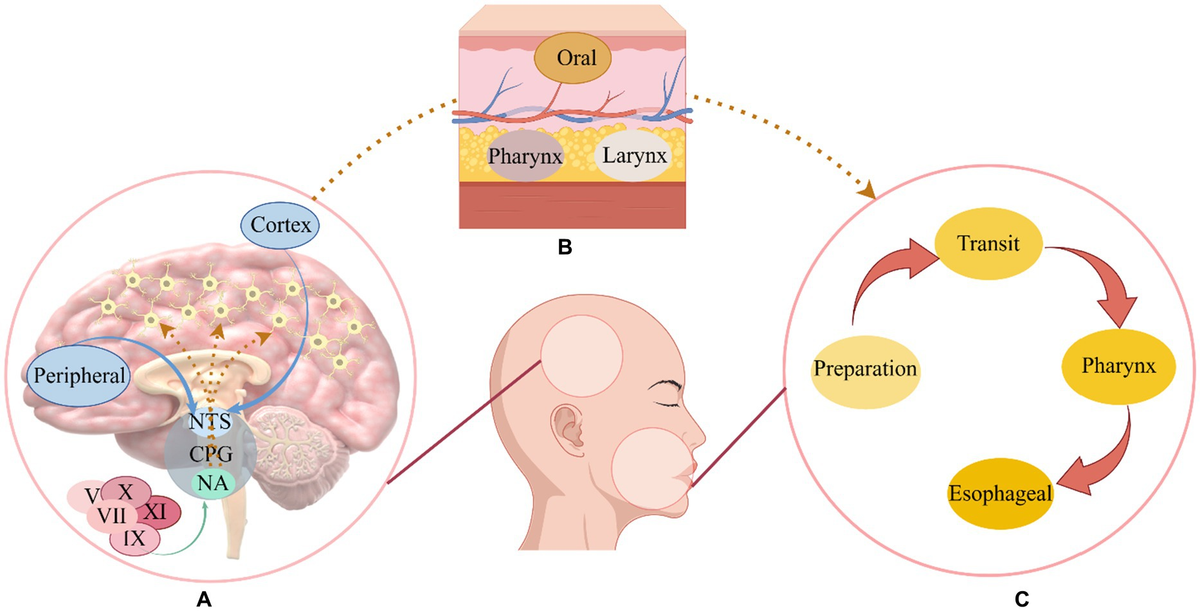 Neurological Swallowing Disorders: Essential Guide