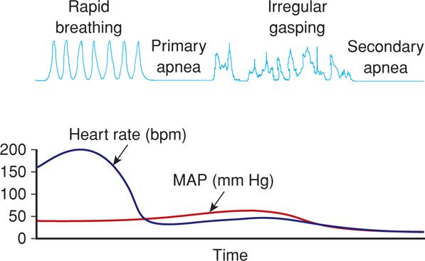 Primary vs Secondary Apnea Newborn: Essential Guide