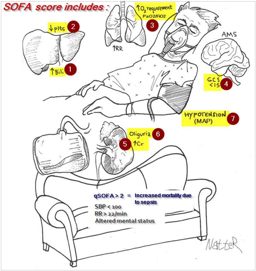 SOFA Score Mnemonic: Quick Guide for Sepsis ICU