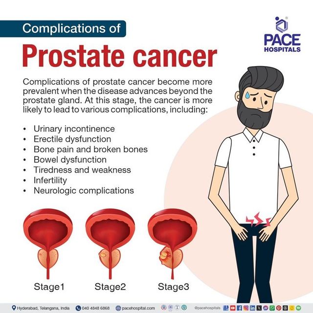 Aggressive Prostate Cancer Symptoms – What to Watch For