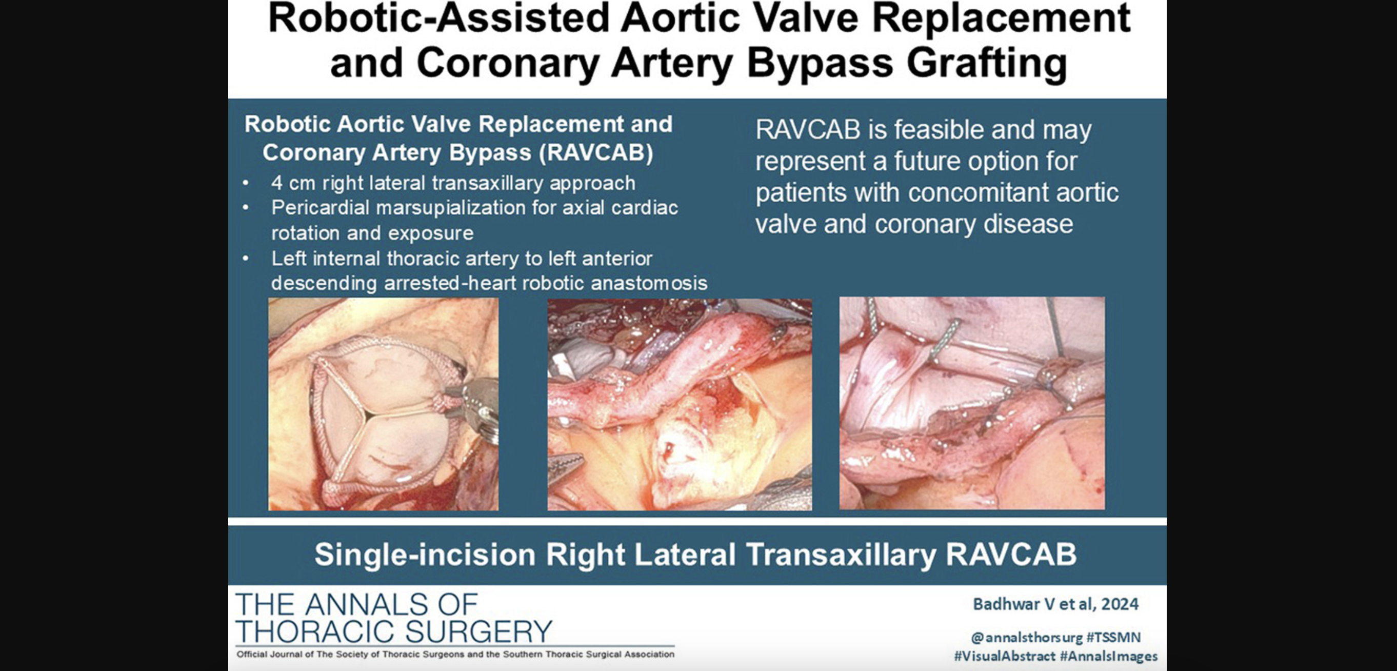 Can Bypass Surgery and Valve Replacement Be Combined?