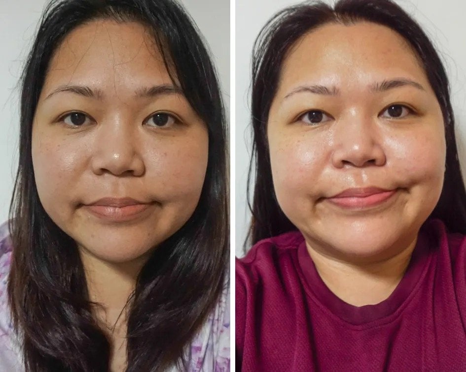 Collagen Weight Loss Reddit: Real User Insights