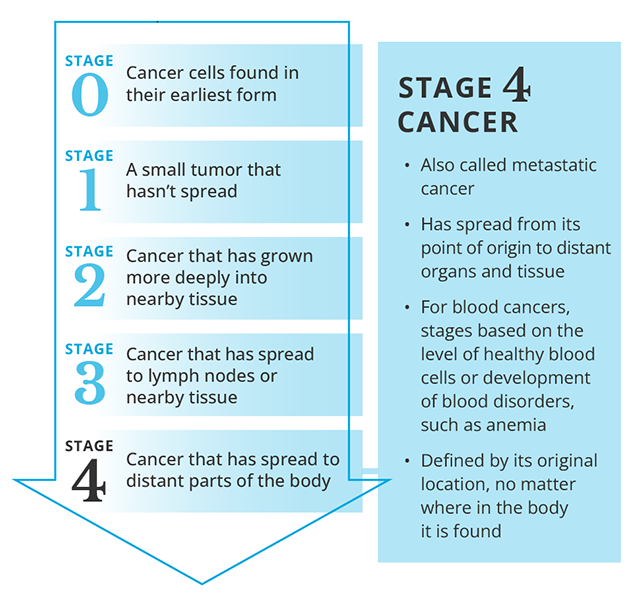 Is stage 4 prostate cancer a death sentence? The truth