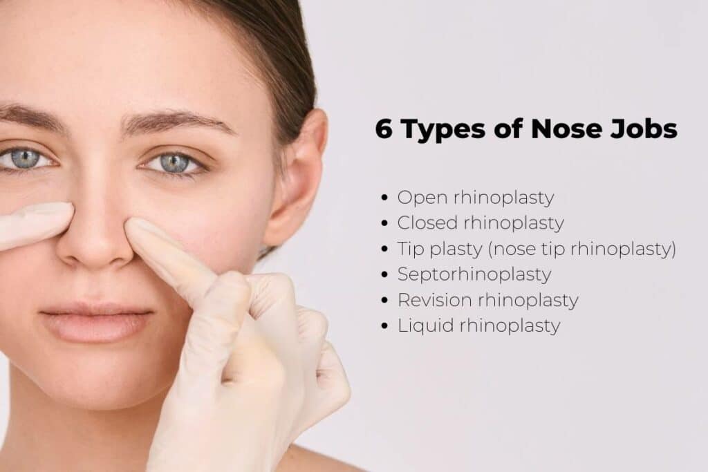Nose Surgery Name: Types, Costs & Recovery Guide You Need