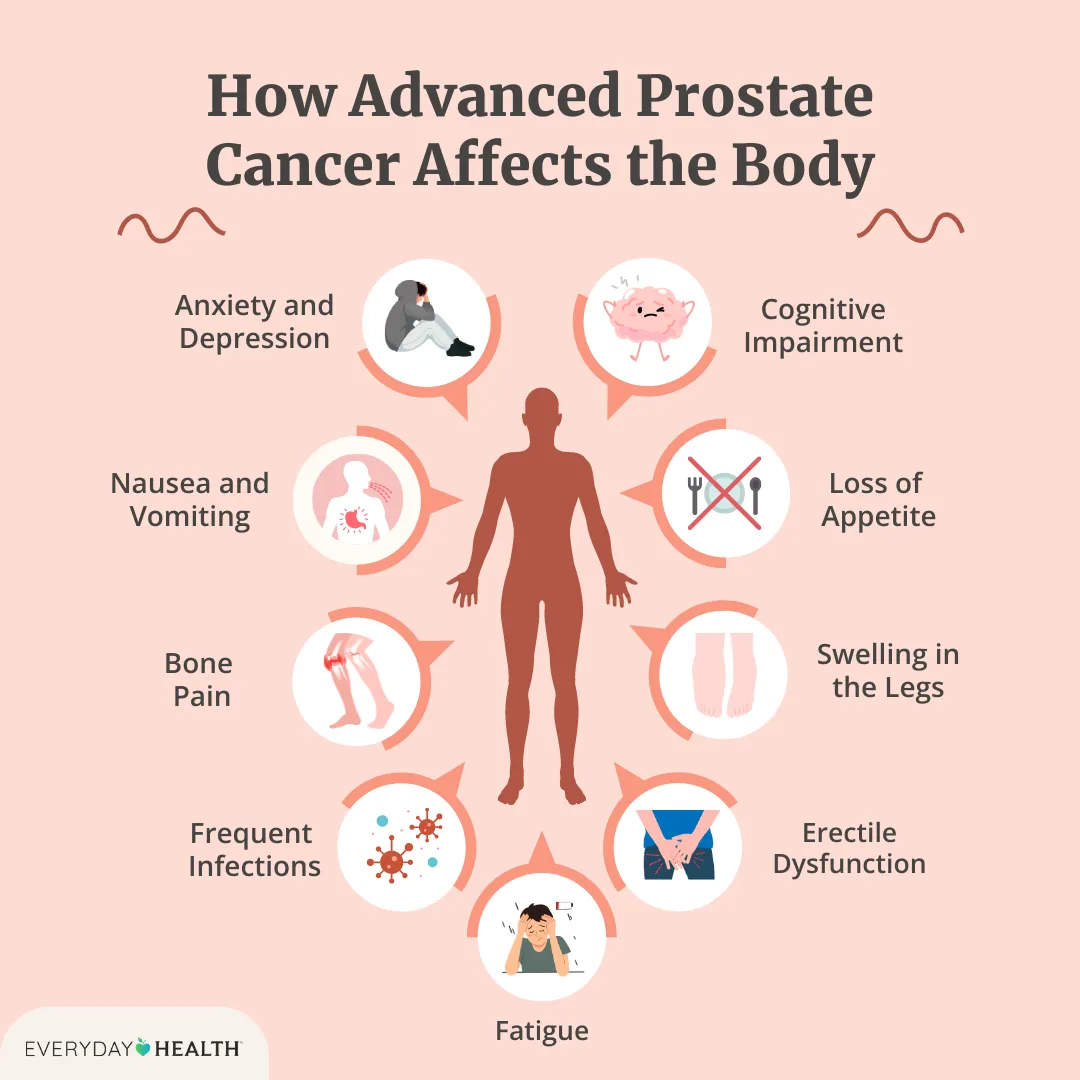 Prostate Cancer Treatment Side Effects Explained