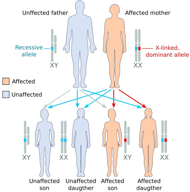 Rett syndrome inheritance X‑linked: essential guide