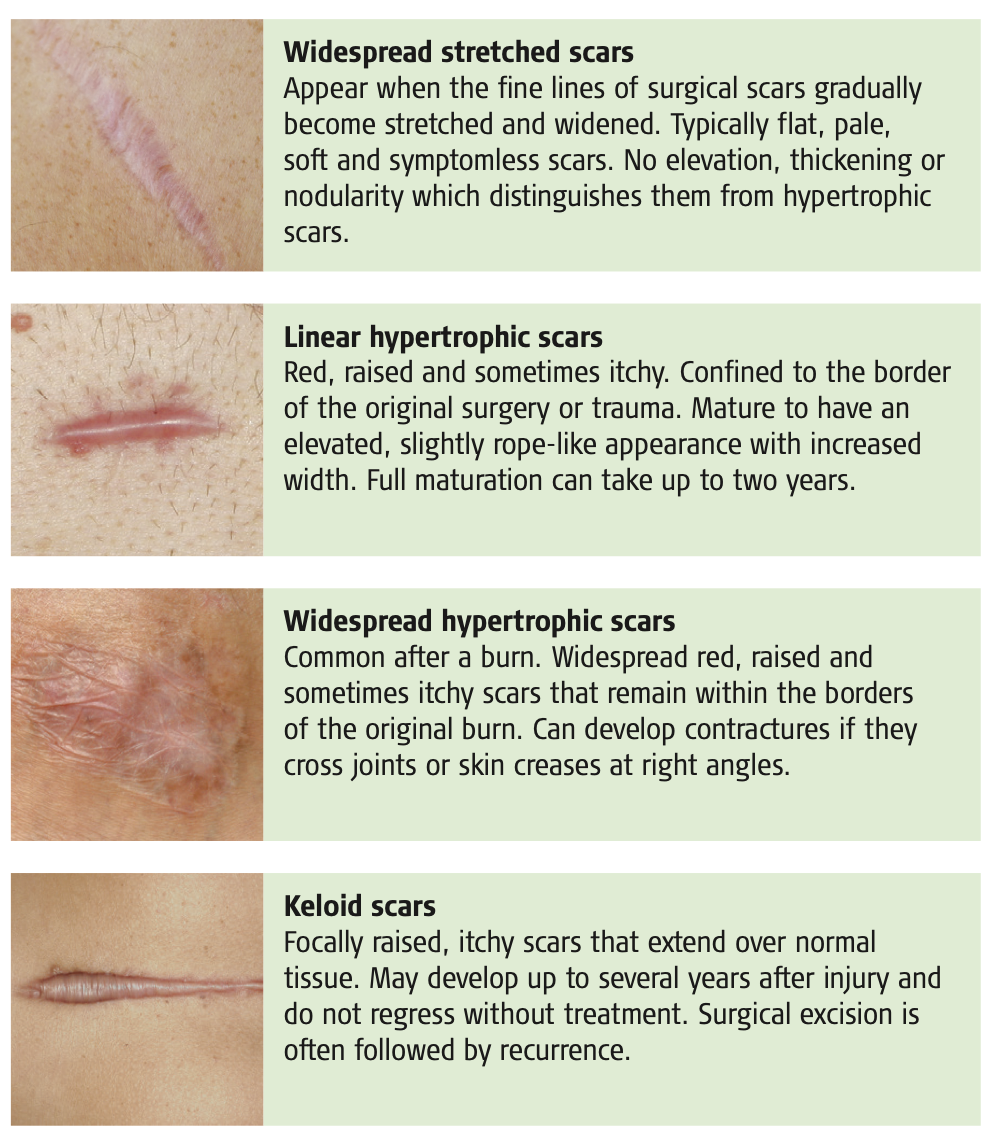 Scar Healing Stages Timeline: What to Expect
