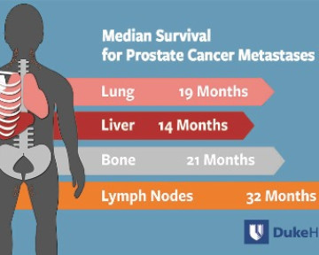 Stage 4 Prostate Cancer 1-Year Survival Rate Explained