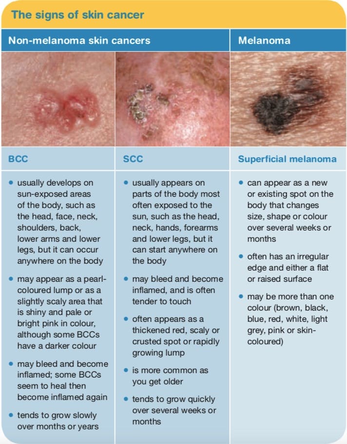 What Are the 7 Warning Signs of Skin Cancer Today?