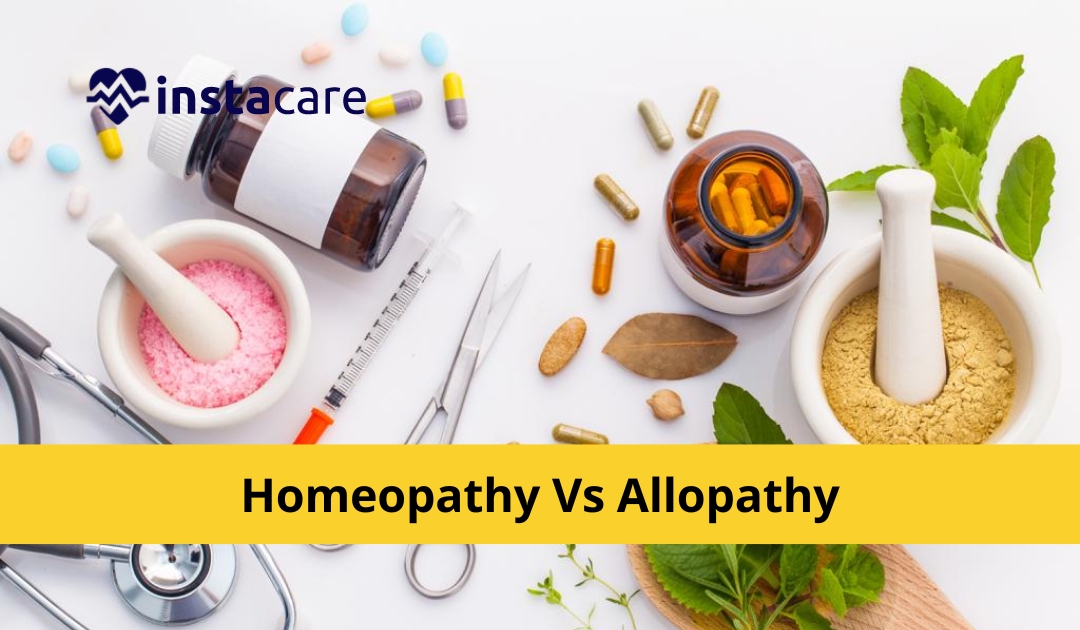 Allopathy or Homeopathy: Which Is Better for Urticaria?