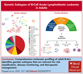 B‑Cell ALL Prognosis in Adults: What You Need to Know
