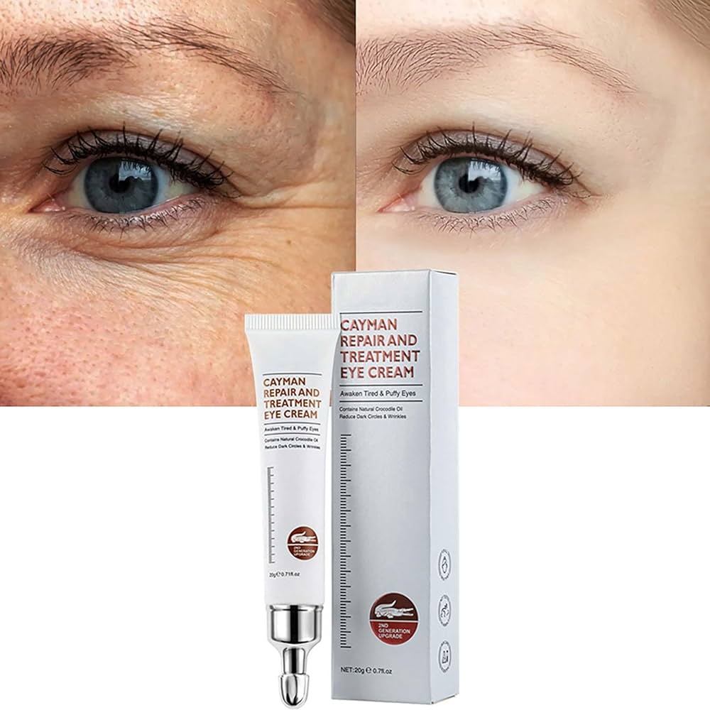 Best Eye Cream for Wrinkles & Dark Circles – 2025 Guide