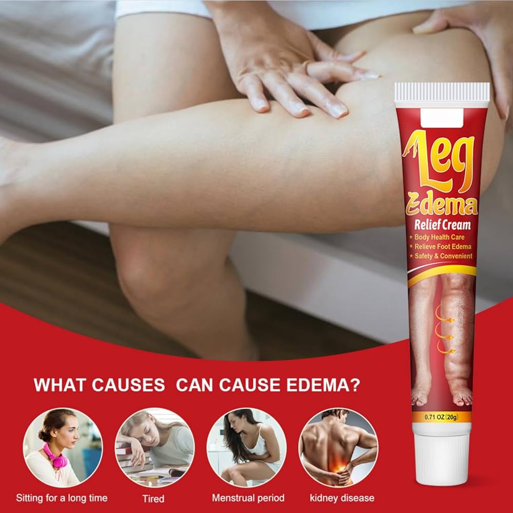 Best Ointment for Edema – What Really Works & Why