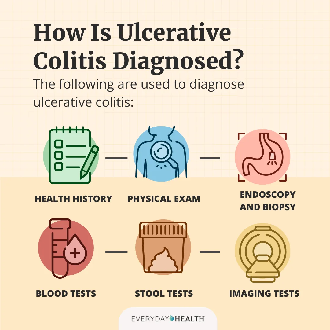 Blood Test for Ulcerative Colitis: Quick Guide