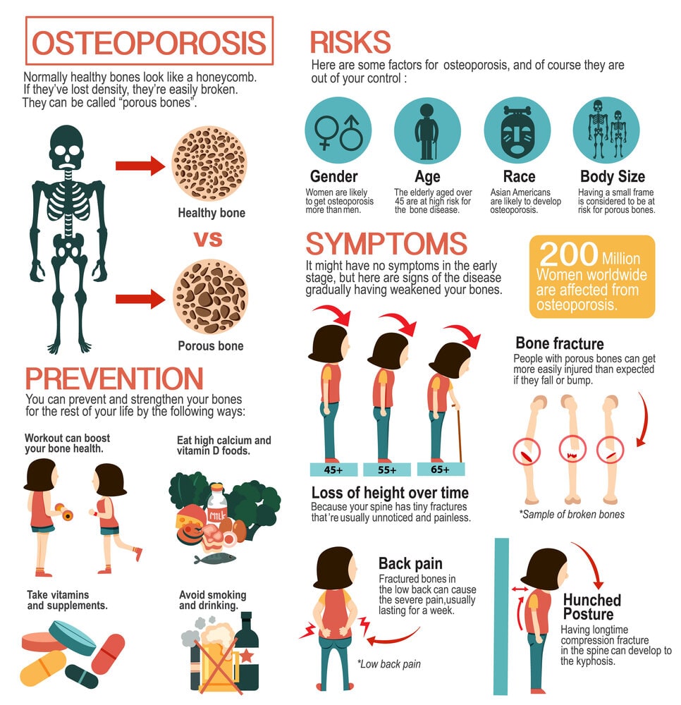 Can Vitamin D Reverse Osteoporosis? Truth Revealed