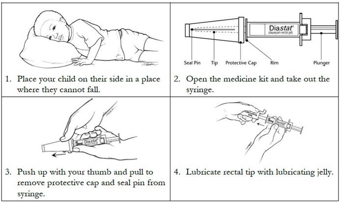 Official Diastat Administration PDF – Quick Guide