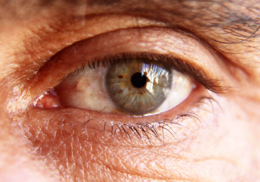 Early Stage Diabetes Eyes Symptoms: Spot Them Now