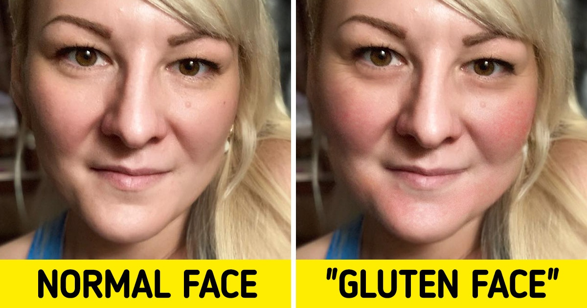 Gluten‑Free Before and After Face: Real Transformations