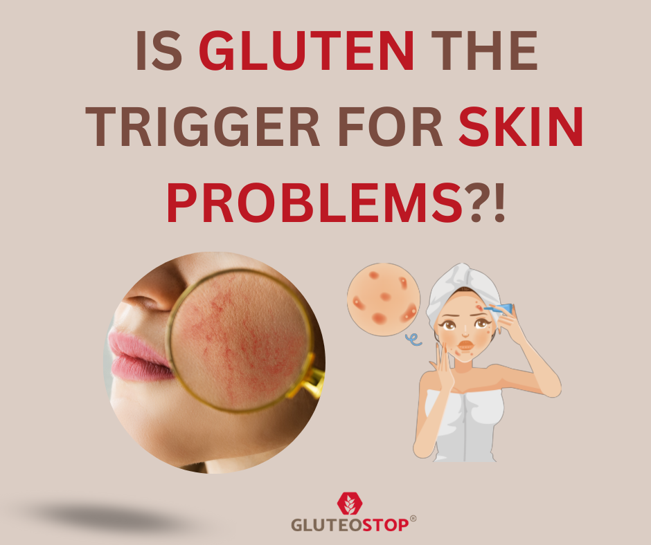 Gluten & Itchy Skin No Rash: What’s Really Happening?